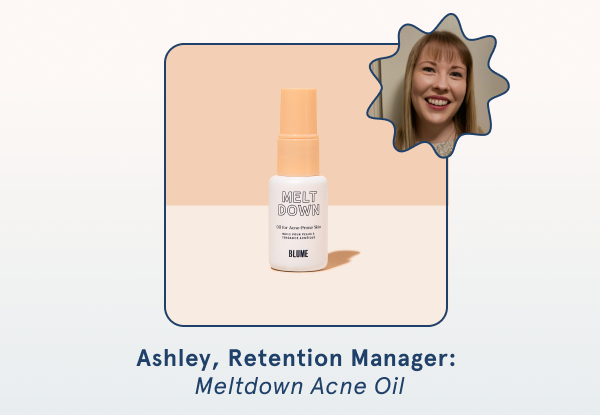 Ashley, Retention Manager: Meltdown Acne Oil